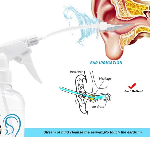 NIB Ear Wax Removal Kit - Picture 8 of 10